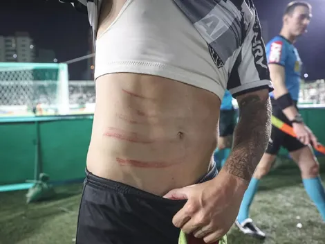 Atlético-MG manda ofício a CBF por cartão vermelho não aplicado no jogo contra o Goiás