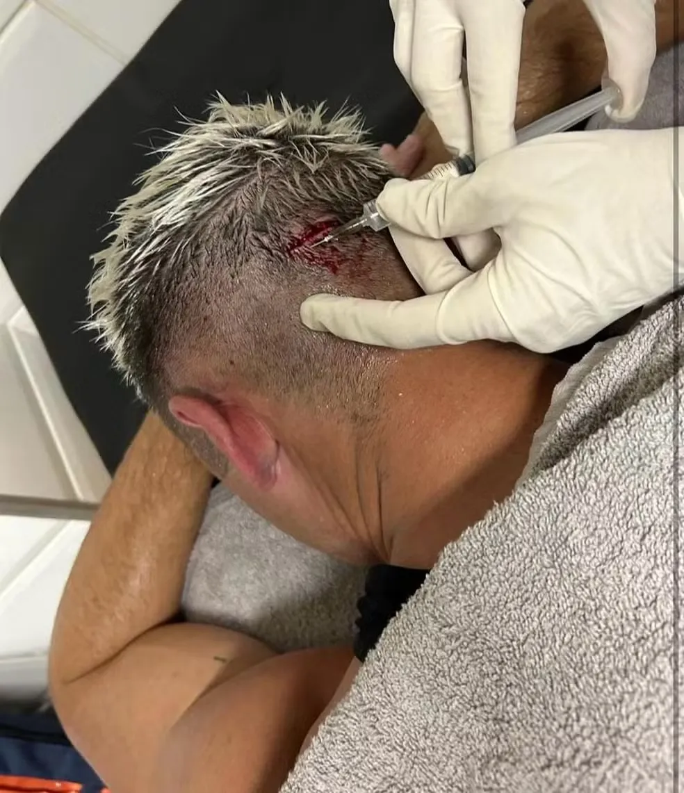 Capasso sendo atentido – Foto: Divulgação Pa