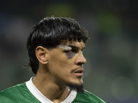 Abel ganha reforço de Gustavo Gómez para Flamengo x Palmeiras