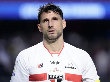 Calleri vive jejum, mas recebe apoio no São Paulo